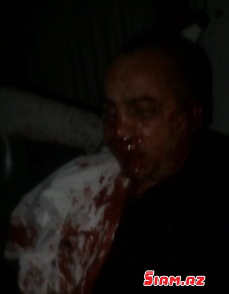 “Lotu Quli”nin yanına desant göndərilən məşhur azərbaycanlı “oğru”nun qulağı kəsildi: DƏHŞƏTLİ FOTOLAR +18 “Lotu Quli”nin yanına desant göndərilən məşhur azərbaycanlı “oğru”nun qulağı kəsildi: DƏHŞƏTLİ FOTOLAR +18